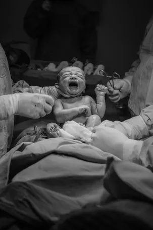 Postnatale Depression: Erkennung und Behandlung